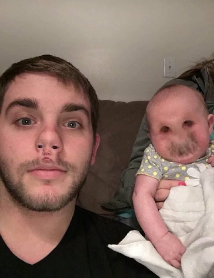 Face Swap Gone Wrong